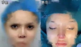 爆料整容视频,视频爆料引发热议